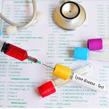 Check spelling or type a new query. New Techniques Detects Lyme Disease Weeks Before Current Tests Healthcare In Europe Com