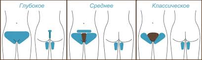 как убрать раздражение в зоне бикини в домашних условиях Polnyj Razdrazhenie V Intimnoj Zone Posle Britya Kak Izbavitsya Ot Zhzheniya I Zuda Top 10 Luchshih Sredstv Ot Razdrazheniya Bikini Brityo Nog Brite