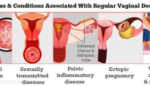 Jika saya memicit pada bahagian puting terbabit, kadangkala ada cecair keluar tetapi jika dibiarkan, tiada puan tidak menerangkan lebih lanjut mengenai cecair keluar dari payudara terbabit sama ada jernih, susu atau darah. Rawatan Faraj Kering Ketika Bersama Suami Kedai Vitamin Butterworth