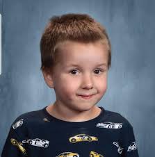 What jobs are suitable after aortic dissection surgery?