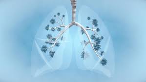 In many cases lung cancer may not show any noticeable symptoms in the early stages. Lung Cancer Symptoms Causes Treatment And Survival Rates