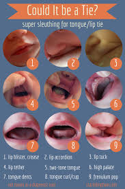 Super Sleuthing For Tongue And Lip Ties Baby Tongue Baby Health Baby Breastfeeding
