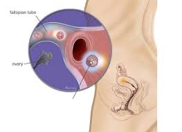 This is when the hormones that control your menstrual cycle triggers bleeding. 3 Weeks Pregnant Spotting The First Signs Of Pregnancy Healthinfi