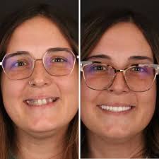 BRITELY DENTURES + IMPLANTS STUDIO