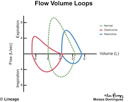 Pulmonary Function Tests Pulmonary Medbullets Step 2 3