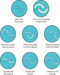 tonometer an overview sciencedirect topics