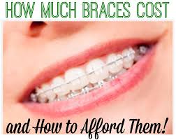 Many parents cringe at the thought of paying for braces for their kids. How Much Braces Cost How To Afford Them