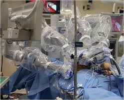 Prostate cancer is one of the most common types of cancer diagnosed in men. Prostate Cance Surgery More Common In Hospitals With Robots The New York Times
