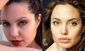 Jolie has also undergone cosmetic procedures. Madison Holiday On Twitter Angelina Jolie Plastic Surgery Https T Co 14n8u7mdkk Angelinajolie Demtownhall Rhoa Marchmadnes Https T Co Jzbpul2pn9