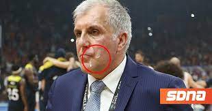 Εμφάνιση αναρτήσεων με ετικέτα κοκκινοσ. Zeliko Omprantobits Ton Eftysan Opadoi Ths Galata Sto Proswpo Pic Sdna