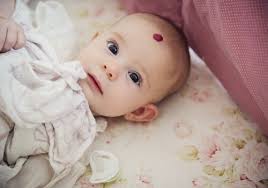 Cancer can also sometimes develop in the tissues surrounding your eyeball or spread to the eye from other parts of the body, such as the lungs or breasts. Strawberry Hemangioma Causes Concerns And Tips