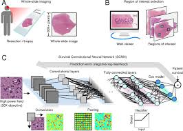 Google's x lab announced in 2014 that they're working on a pill that'll send microscopic particles into your bloodstream, capable of identifying cancers and even future heart attacks long before they become deadly. Predicting Cancer Outcomes From Histology And Genomics Using Convolutional Networks Pnas