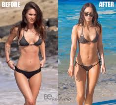 Résultat de recherche d'images pour "breast implant before and after"