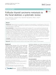 Your doctor will want to find out the stage of your cancer to help decide what type of treatment is best for you. Pdf Follicular Thyroid Carcinoma Metastasis To The Facial Skeleton A Systematic Review