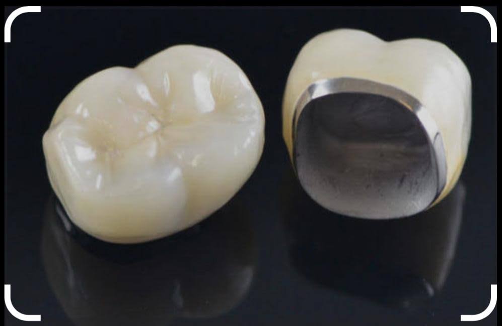 PFM CROWNS product image