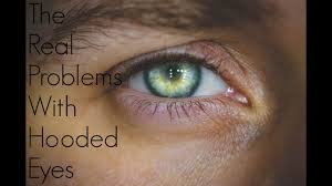 As you age, your eyelids stretch, and the muscles supporting them weaken. The Problem Solutions For Very Hooded Eyes Youtube