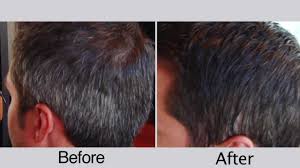 before and after mens hair color for covering gray hair