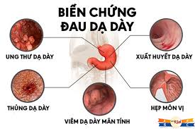 Đau dạ dày nguyên nhân do đâu? Và mẹo trị bệnh hiệu quả