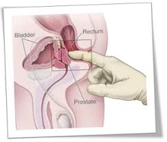 This is a perfect way to remove the pain that you feel in your prostate gland. Prostate Massage Therapy Clinic Prostate Health Center