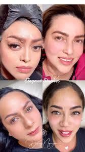 Nano Fusion Facial by Stephanie Hung I have been getting Nano Fusion very  often now. It's not only I don't have time to take care of myself, Salmon  DNA serum and Led