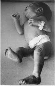 Place legs between the leg upholsteries. Pep Web The Newborn In The Intensive Care Unit A Neuropsychoanalytic Prevention Model