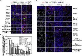 Initially, it's meant to give the appearance of fire and ice; Down Regulation Of Mir 301a 3p Reduces Burn Induced Vascular Endothelial Apoptosis By Potentiating Hmsc Secreted Igf 1 And Pi3k Akt Foxo3a Pathway Sciencedirect