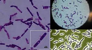 什麼是「蠟樣芽孢桿菌嘔吐毒素」？ 蠟樣芽孢桿菌（Bacillus cereus）是一種在自然環境中廣泛存在的條件致病菌，特別容易污染</div><!-- 询价记录 --><div id=