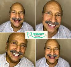 Hi Dent Dr. Ashraf Kamel