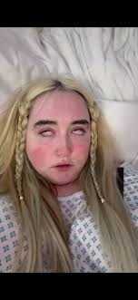 Stony Brook Hospital Inpatient