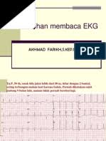 · lebih jauh ke kanan adalah interpretasi dari ekg yang ditulis (ini mungkin hilang dalam ekg 'segar', namun kemudian interpretasi kardiolog atau komputer akan ditambahkan) · bagian kiri bawah adalah 'kecepatan kertas' (25 mm / s pada sumbu horizontal), sensitivitas (10mm / mv) dan frekuensi saringan (40hz, menyaring suara dari lampu misalnya). Contoh Soal Ekg 2 Pdf