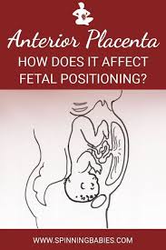 Anterior Placenta What It Means For You And Your Baby Spinning Babies Anterior Placenta Spinning Babies Placenta