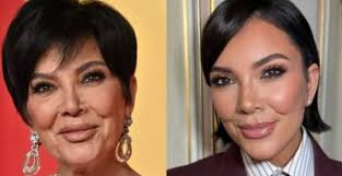 I'm not even gon hold you. That facelift is PHENOMENAL. She looks 20 years  younger. Wow. It's actually wild how many years it took off her face.