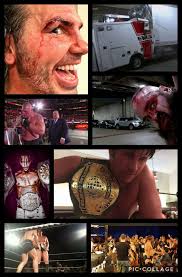 A true moment of greatness in wrestling history. Dan Severn battled back  from setbacks and injuries to conquer the reigning Soviet World Champion —  proving that perseverance, preparation, and pure willpower can