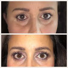 I've done it for a few months and it's worth it to me. Do It Yourself Lash Lift At Home