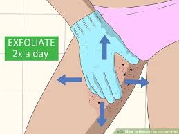 You can also apply a warm compress on the area or gently exfoliate it with a washcloth to help soften the superficial layer of skin, allowing the ingrown pubic hair to break through. How To Pop An Ingrown Hair In Your Pubic Area