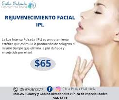 Los beneficios de la IPL son muy numerosos. Destacamos algunos de ellos a  continuación: Aporta luminosidad al rostro. Difumina las primeras arrugas.  Elimina el acné, la rosácea y las manchas faciales. Mejorar
