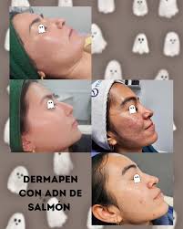 La magia solo dura si persiste el deseo..." y mi deseo es ser una gran  dermatologa. Agradecimiento especial a mi familia que siempre me apoyó en  este camino lleno de baches, a