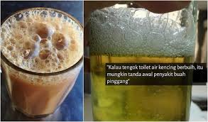 Saya tanya doktor adakah ubat dapat menghentikan penyakit buah pinggang ini daripada merosakkan buah pinggang saya. Penawar Sakit Buah Pinggang Kencing Manis Darah Tinggi Home Facebook