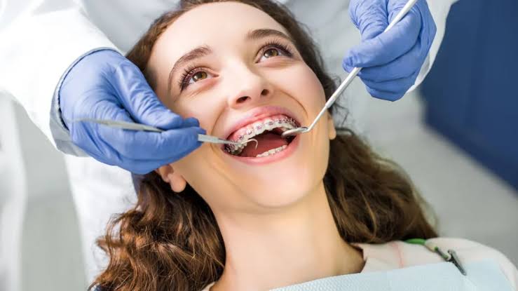 How to Take Care of Braces: Essential Tips