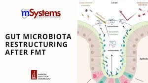 Protein synthesis malfunctions in test tubes. Msystems Journal Homepage