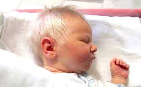 Lately, so many women are dyeing their hair all shades of white, grey, and silver. Baby Boy Born With All White Hair Stuns Doctors Viral Murphy