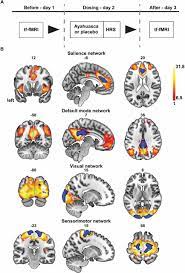 Subacute Effects Of The Psychedelic Ayahuasca On The Salience And Default Mode Networks Medrxiv