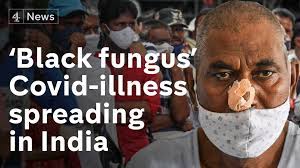 May 28, 2021 · black fungus panic: Channel 4 News Covid Linked Black Fungus Infection Spreading In India Facebook
