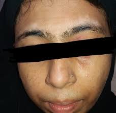 T Bringing Classical and Contemporary Homoeopathy ogether