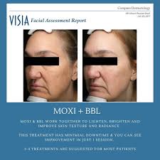 COMPASS DERMATOLOGY (@compassdermatology) · Instagram 照片和视频