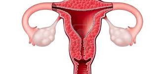 Image result for Vaginitis
