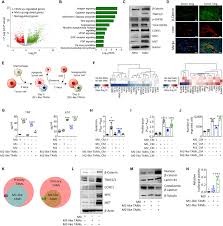 The area's natural beauty can be seen at mul ddel e shim pang offers 37 accommodations with coffee/tea makers and hair dryers. Reprogramming Of Tumor Associated Macrophages By Targeting B Catenin Fosl2 Arid5a Signaling A Potential Treatment Of Lung Cancer Science Advances