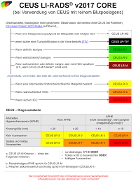 Liver cancer is the third most common cause of cancer related death worldwide, 90% being hepatocellular carcinoma (hcc) and about half of all hccs estimated to occur in china. Https Www Acr Org Media Acr Files Rads Li Rads Translations Li Rads 2017 Ceus German Pdf