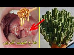 معجزة الشفاء علاج أمي ل التهاب اللوزتين و علاج الحلاقم من أول استعمال وقسما بالله مضمونة Youtube Homemade Remedies Asparagus Health
