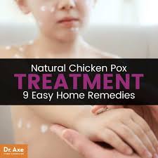 During the 'pox' time, for chinese, they have a lot of 'pantang larang'. Chicken Pox Food Recipes Travel Car Insurance